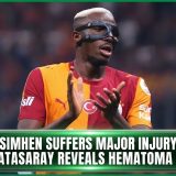 Victor Osimhen Suffers Major Injury Setback As Galatasaray Reveals Hematoma Details